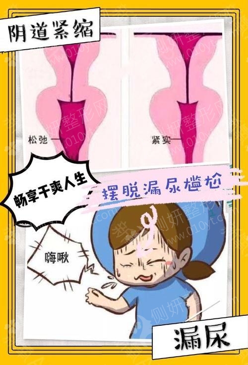 惠州中信医院私密紧致术