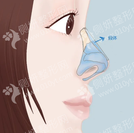 益阳格莱美整形医院怎么样