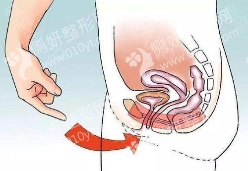 乌鲁木齐伊丽莎白整形美容医院私密紧致术