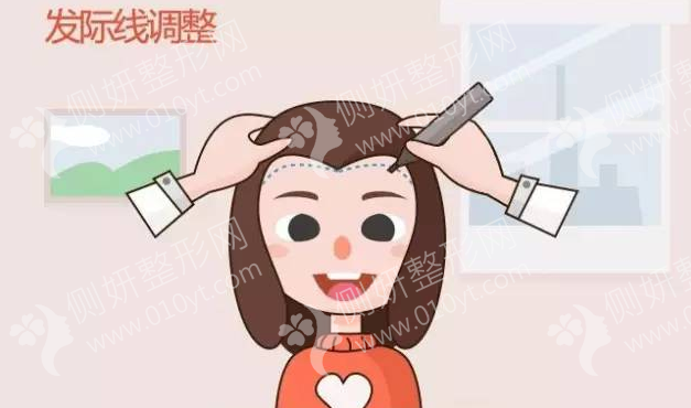 东莞科生植发FUE种植头发