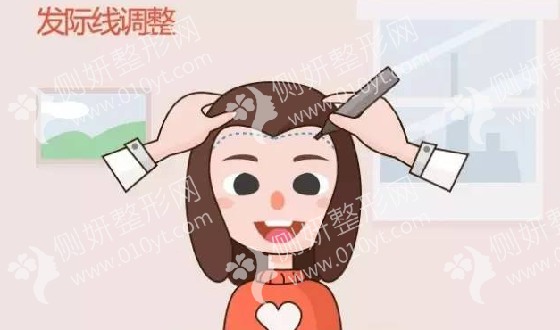 深圳阳光医疗美容医院FUE种植头发