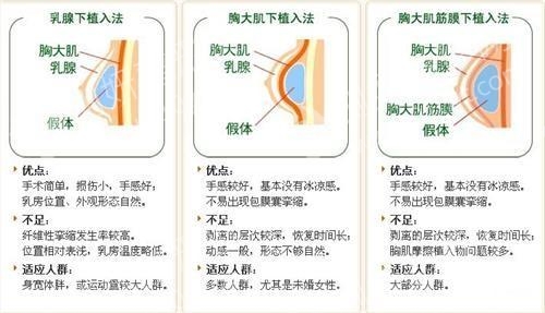 大连医科大学附属第一医院美容科隆胸