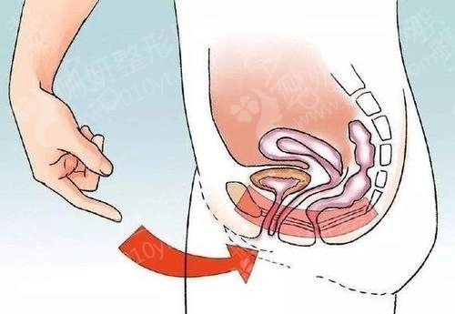 宁波海曙美莱私密整形
