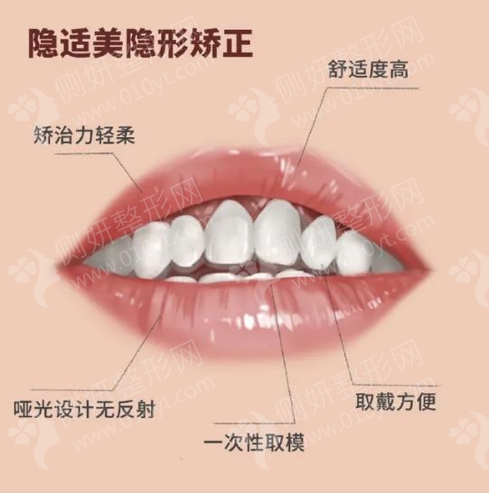 成都团圆口腔医院牙齿矫正