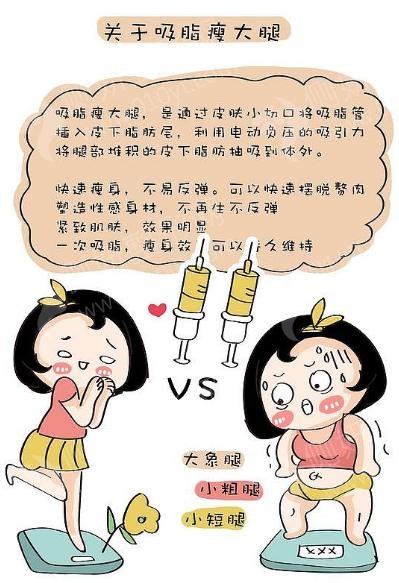 成都铜雀台整形美容医院吸脂手术