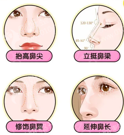 梧州市人民医院整形外科微晶瓷隆鼻
