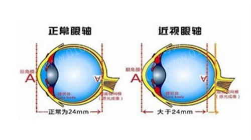 济南眼科近视手术医院排名