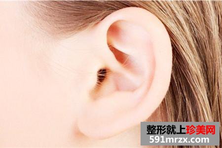 做完耳垂再造手术后要注意哪些