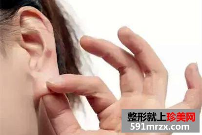 隐耳修复手术有何优势