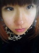 王者之心祛斑+嫩肤美白跟斑挥挥手