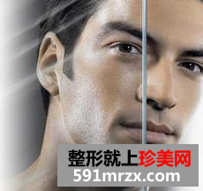 怎么样脱毛效果最佳