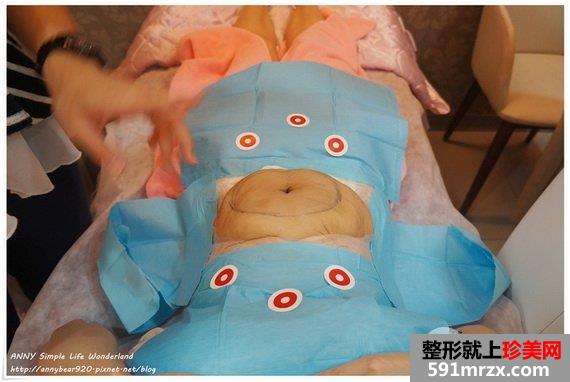 标靶震波定位照片