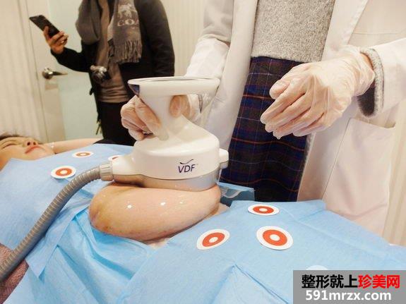欧萃学聚焦超音波溶脂