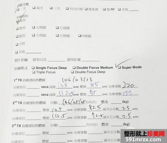 欧萃学聚焦超音波瘦小腹