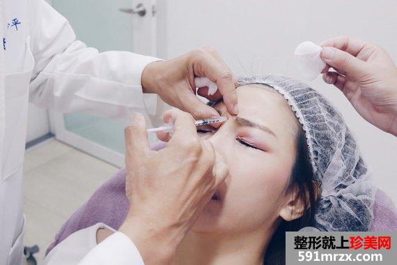 施打肉毒桿菌