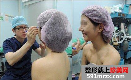 隆鼻前医生在画线