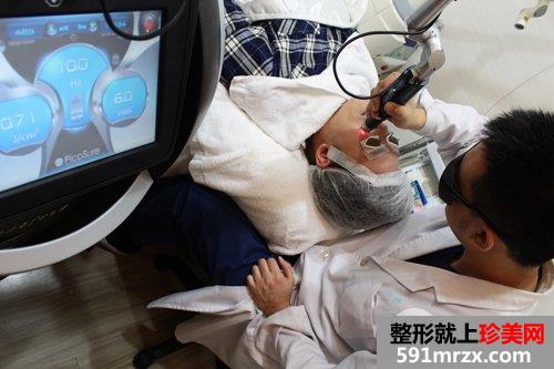 皮秒激光治疗开始