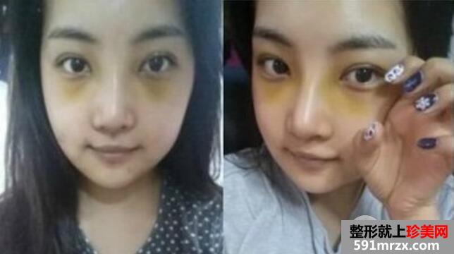 面部轮廓改脸型整形手术效果图前后对比惊呆小伙伴