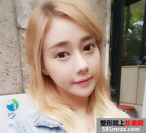 隆鼻后恢复过程是怎样的