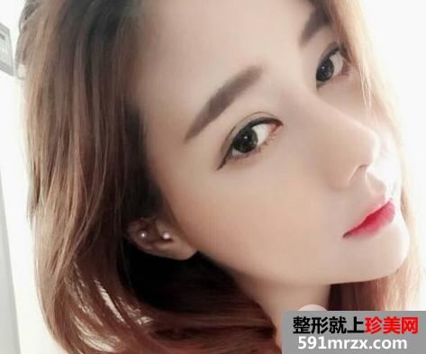 只要不感染不变形，假体不需要取出？
