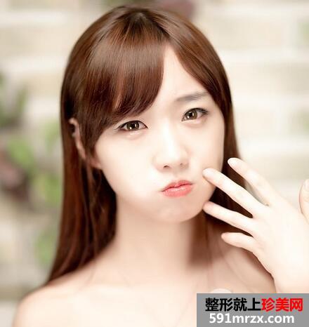 驼峰鼻如何矫正?
