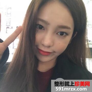 驼峰鼻矫正术后如何护理?
