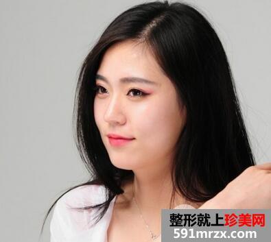 长沙驼峰鼻矫正的价格是多少?
