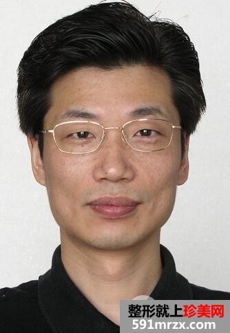 浙医二院整形科多少钱|整形价格表