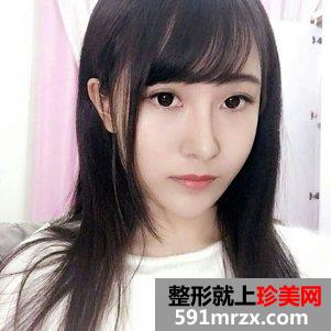 韩式芭比翘鼻恢复图片 鼻综合手术前后对比照片