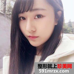 韩式芭比翘鼻恢复图片 鼻综合手术前后对比照片
