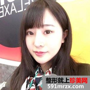 韩式芭比翘鼻恢复图片 鼻综合手术前后对比照片