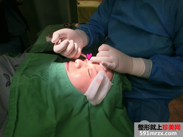语昕手术_170217_0023.png