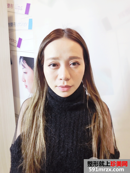 语昕手术_170217_0145.png