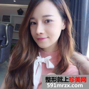 蒜头鼻整形对比照片 蒜头鼻整形恢复全过程