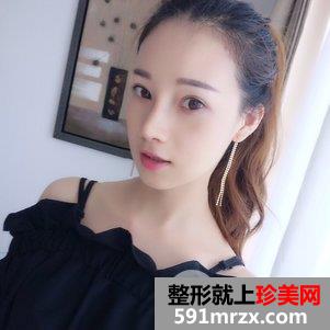 蒜头鼻整形对比照片 蒜头鼻整形恢复全过程