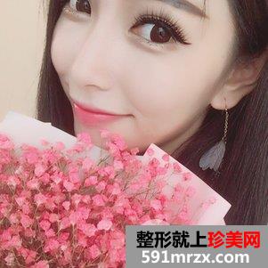 垫鼻根效果怎么样？鼻综合整形前后对比及恢复过程分享