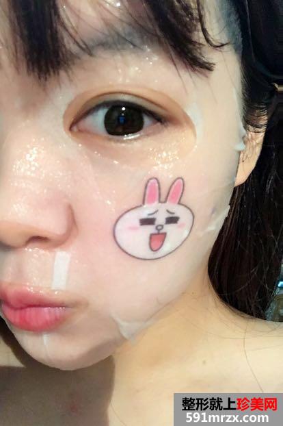 双眼皮开眼角恢复过程图，最真实案例照片