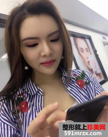 深圳仁安雅整形价格表|脂肪全脸填充个人经历分享前后对比照