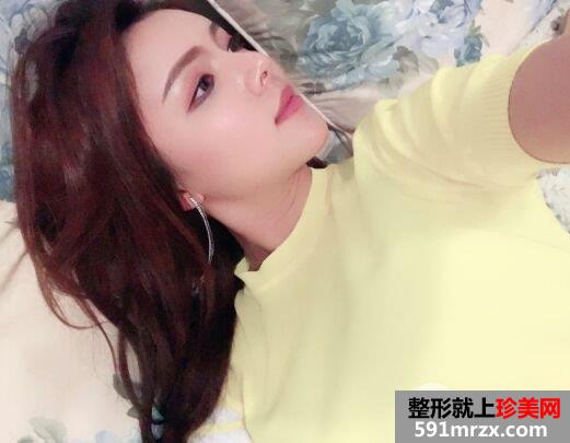 深圳仁安雅整形价格表|脂肪全脸填充个人经历分享前后对比照