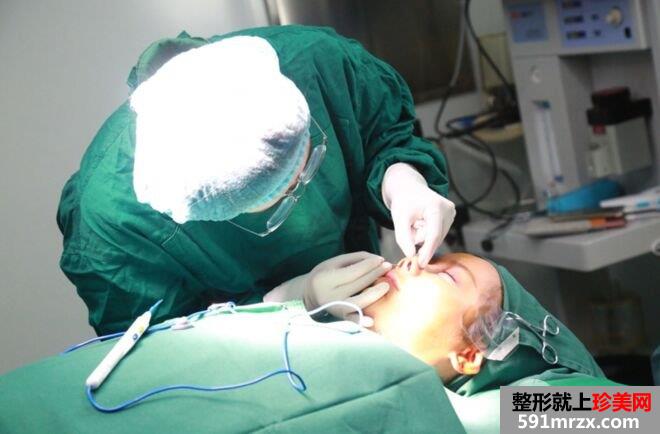 鼻头缩小手术多少钱|鼻头缩小鼻综合整形真实案例对比图