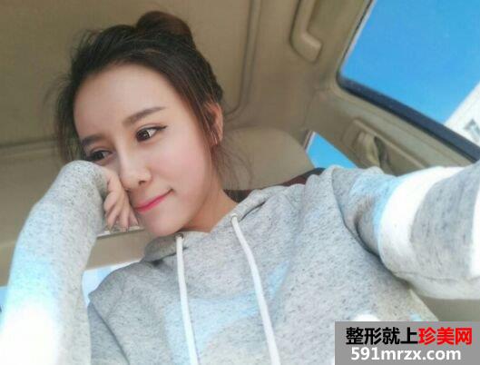鼻头缩小手术多少钱|鼻头缩小鼻综合整形真实案例对比图