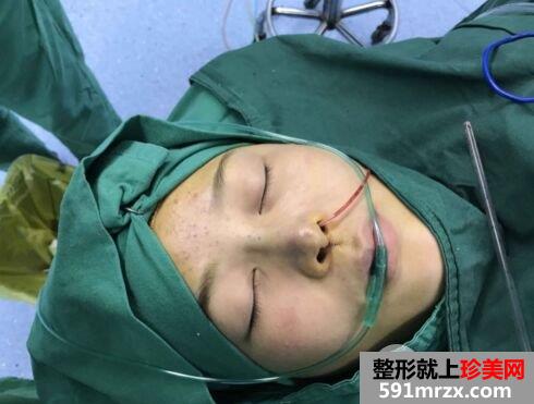 鼻子怎么变挺|长沙美莱鼻综合整形案例恢复效果分享