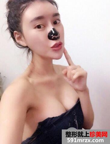 宁波江东壹加壹假体隆胸手术案例分享，还有更多效果图