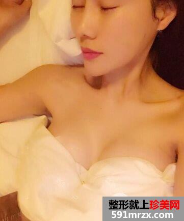 宁波江东壹加壹假体隆胸手术案例分享，还有更多效果图