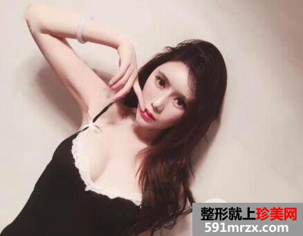 宁波江东壹加壹假体隆胸手术案例分享，还有更多效果图