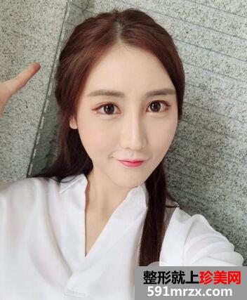 武汉洪山爱美汇面部吸脂真实案例，呈现小巧完美脸型