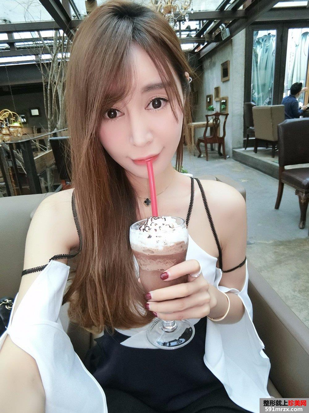 双下巴吸脂真人案例，更多前后对比照片分享