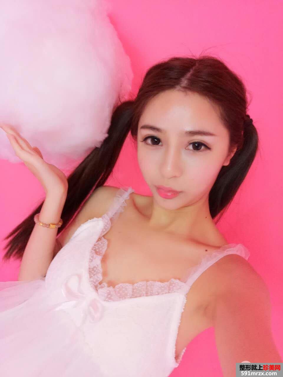 曼托假体隆胸真实案例对比图分享 立现傲人身材