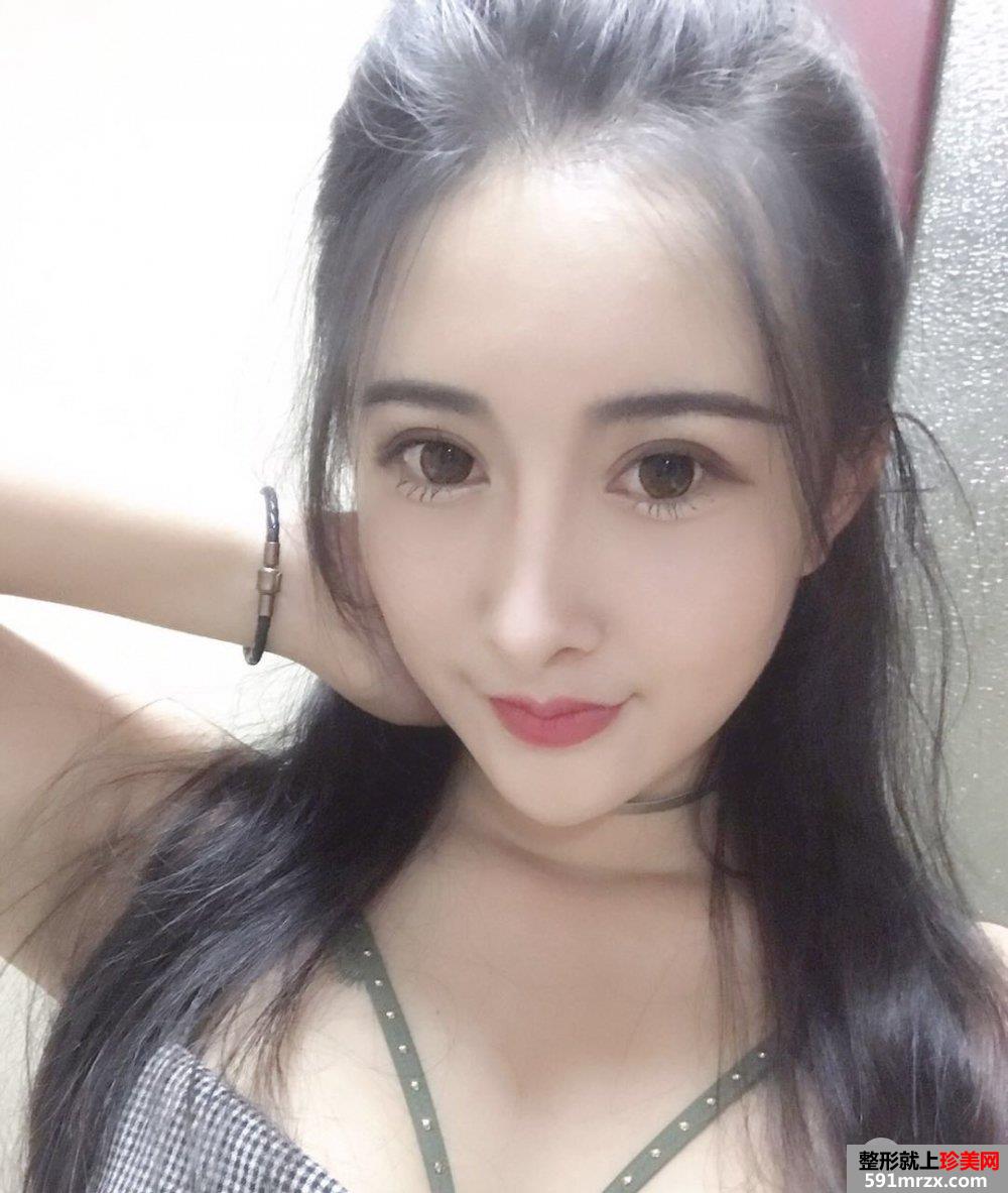 自体脂肪面部填充打造完美童颜，真人案例对比图分享