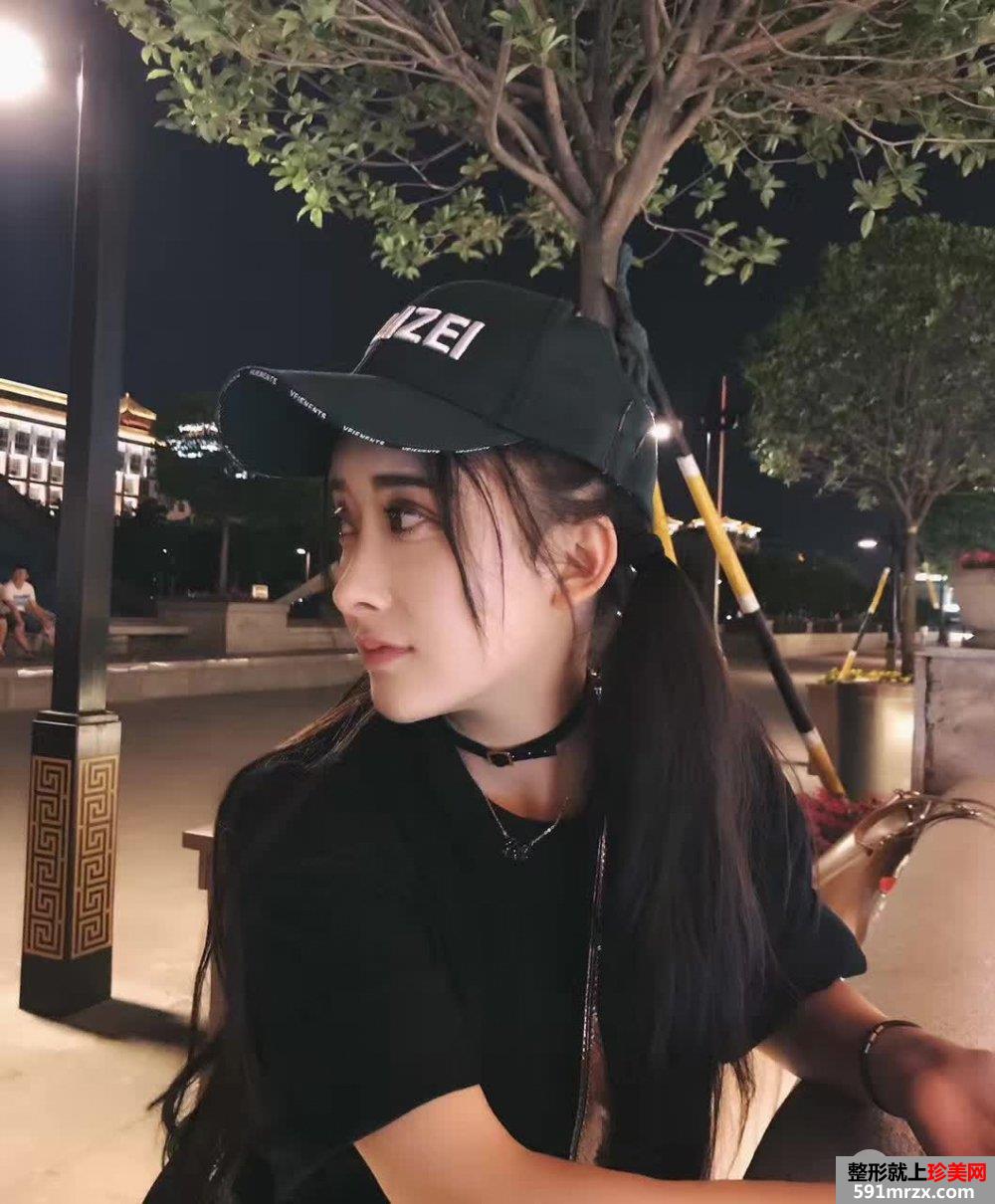 自体脂肪面部填充打造完美童颜，真人案例对比图分享